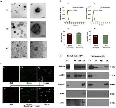 Differential Expression of Keratinocyte-Derived Extracellular Vesicle Mirnas Discriminate Exosomes From Apoptotic Bodies and Microvesicles